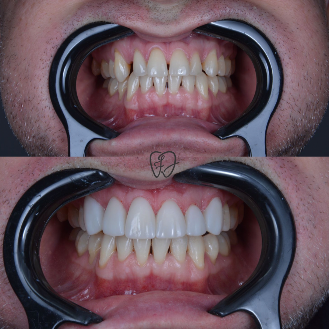 90D16079-DE8B-4BD7-80C2-79B2DEA74CA4