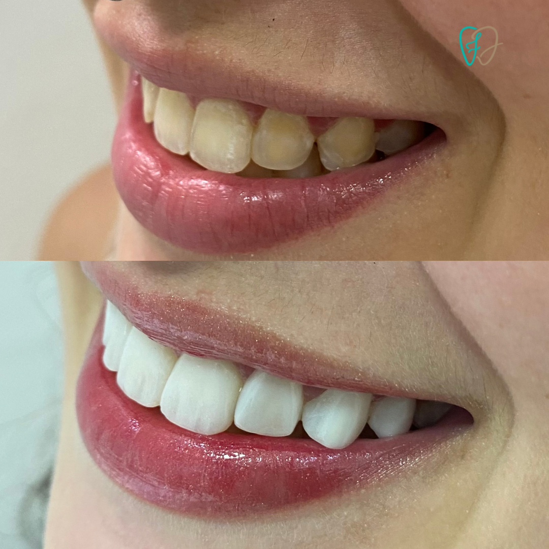 BC864708-580C-4CAC-B317-8E12C2D28F3E